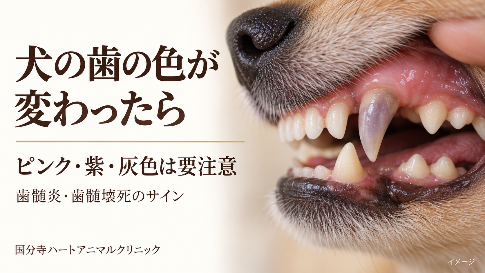 紫灰色に変色した犬の上顎犬歯のイメージ。歯の色の変化と歯髄炎・歯髄壊死についての案内。